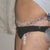 7 days post op