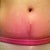 9 weeks PO and up close and personal with my newest scar.