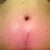 See how long it really is?  That's what used to be my belly button. Ugh. It's supposed to flatten out. I hope so!