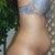 The grossness that is my stomach.