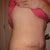 Incision was nice and low - will be easily hidden thankfully