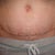 You can see my belly button problem here.....nothing big, but still isn't right.