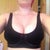 sports bra with implants before removal 17/7/12