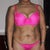 Before surgery, I can't believe I lived with all this skin for so man years!