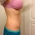 Almost 9wks po. Love this side!!!