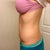 Almost 9wks po. Not bad, still obviously swollen compared to other side.