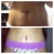 8 days post op,  before &  after