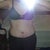 3 weeks 2 days post-op, front view