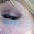 April 12, 2012 Black Eye right after appointment.