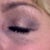 May 12, 2012 
Approximately 4 weeks later.
Covered with Makeup but still visable.