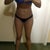 Day 9, Abdomen and waist really swollen.