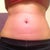 Before Front
