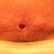 4 weeks post op, after dry wicking the "hole"  you can see how it is closing from the inside out. (This pic. looks odd b/c I forgot to turn on the flash!)
