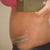 Side view...a little swollen.