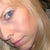 This is my face before I had any IPL done. My skin was quite healthy. It looked nice. Not perfect, but very nice and rather smooth. This picture was taken the year prior to me having any IPL, so I'd say it was taken in 2008 or 2009.