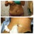 before and after