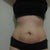 4 weeks after