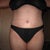 6 weeks Post-Op