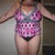 6 weeks Post-Op