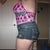 6 weeks Post-Op