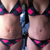 Before and Post Op 3 weeks!