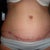 9 weeks