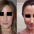 BEFORE VS. MONTH 4