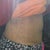 One week and one day from endo ab muscle repair.  You see the upper bulge just above my BB still.