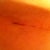 9 days post op, scar under my left breast