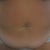 Frontal shot of the gut