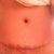 Scar and belly button