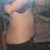 belly one week pre-op