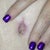 Belly button healed up