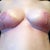 Underneath of breasts day 12