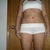 3 weeks post op