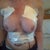 24 hours post op
