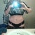 Not as swollen and pretty excited about my new belly button... :o)