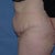 Other side, before.  Part of my wonders with this gigantic jiggly rear end if it's even worth it... but here we go!  :)