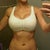 one month post op