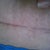 my incision looking better each week
