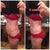 Before versus 6 weeks
