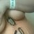 POD10- I clipped my drains to a chain or necklace when showering--last drain was taken out this day 4/5/13