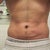 5 weeks, closer shot