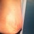 Still swollen- three weeks