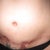14 weeks post op
