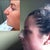 Before and After Profile