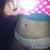 2 weeks post BB revision