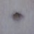 BB close up. You can see my circular scar but it is already turning white.