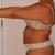 Pre Op Side View, morning of procedure (5/18)