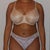 35 Days Post Op Front View (6/23)